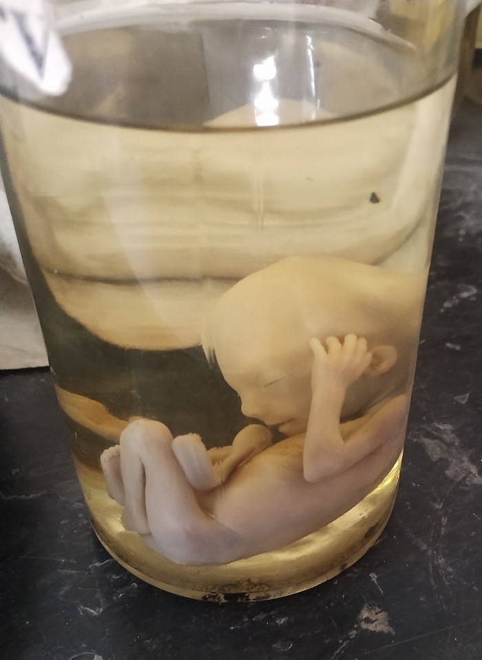Human Embryo